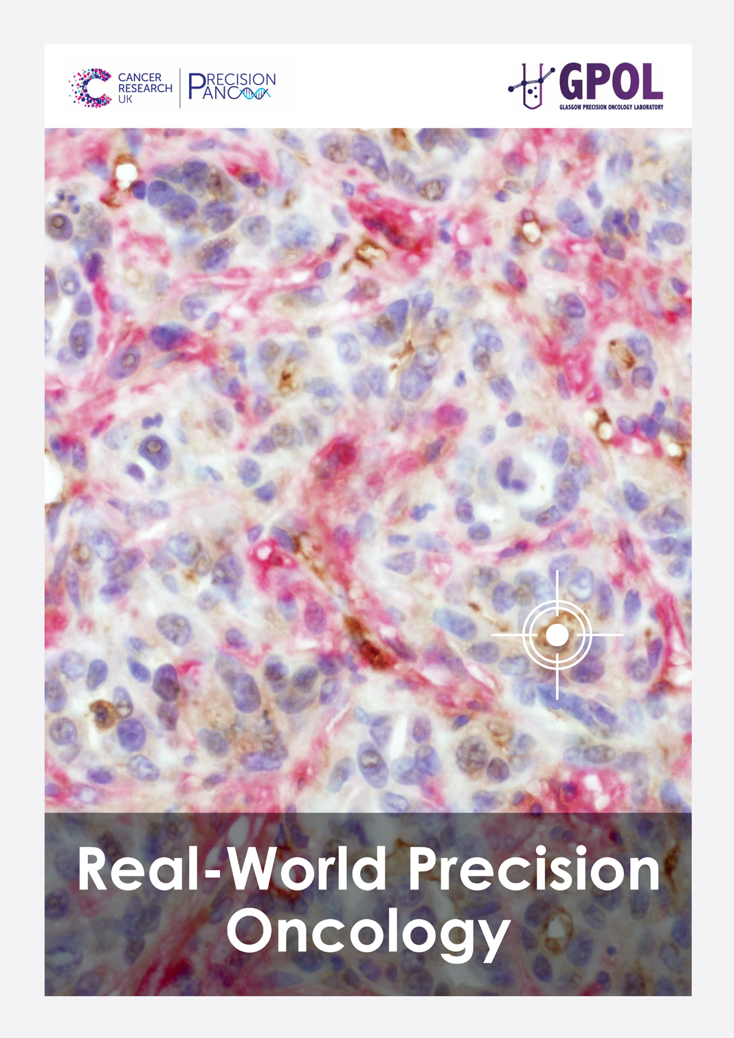 Real world precision oncology
