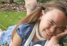 Mucopolysaccharidoses – one disease with many faces