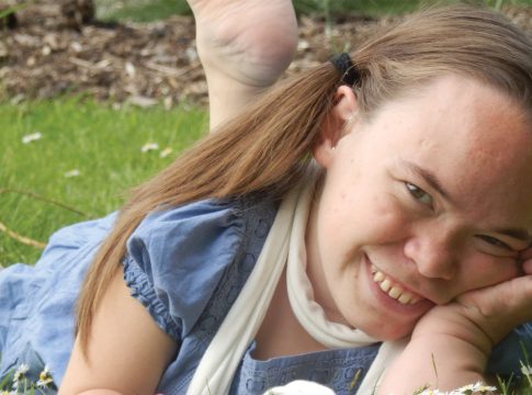 Mucopolysaccharidoses – one disease with many faces