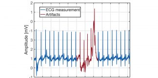 Accurate Monitoring of Cardiovascular Activity