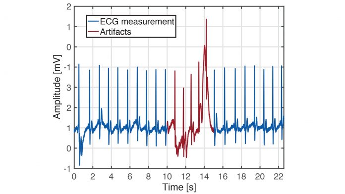 Accurate Monitoring of Cardiovascular Activity