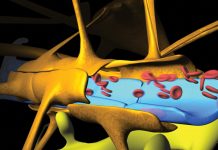 Traumatic brain injury: what is the future?