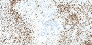 Immuno-Oncology: the power of patients’ immune systems to fight cancer