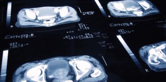 Exploring different imaging technologies for prostate cancer
