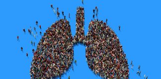 Conquering thoracic cancers worldwide