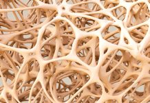 ROS: Finding a cure for osteoporosis osteoporosis