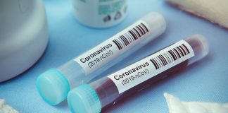 Coronavirus research