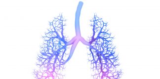 Inhaled chemotherapy changing the face of lung cancer treatment