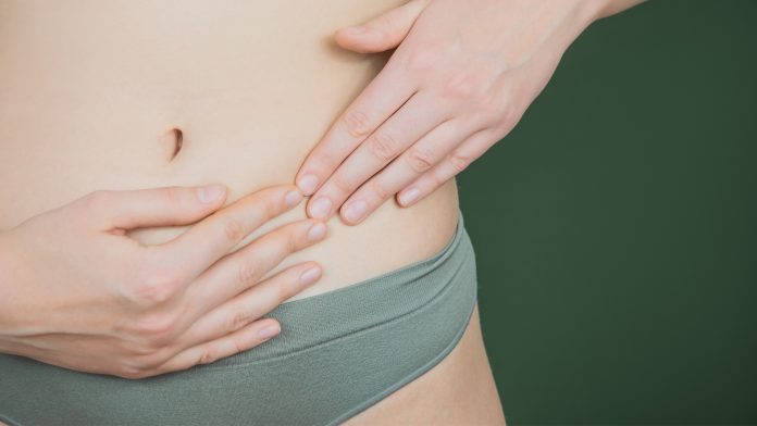 Polycystic ovarian syndrome