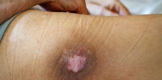 Bio-ink skin therapy