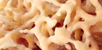 Preventing hip fractures in Hong Kong’s older population