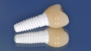 Ceramic dental implants