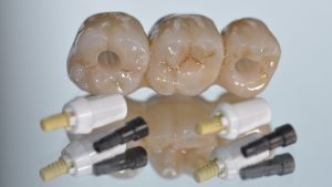 Ceramic dental implants