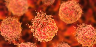 prostate cancer secondary tumours