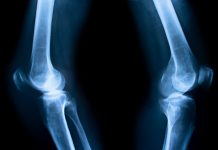 Researchers 3D bioprint fibrocartilage bioprint fibrocartilage