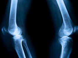 bioprint fibrocartilage