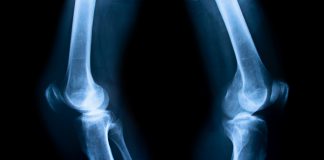 bioprint fibrocartilage