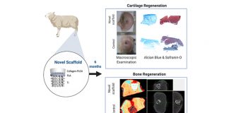 osteochondral scaffold