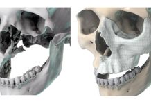 Regenerating musculoskeletal tissues musculoskeletal