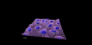 effects of nanoplastics on human health