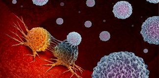 lymphocytic leukaemia