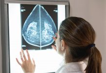 Scaffold-guided breast reconstruction Scaffold-guided breast reconstruction