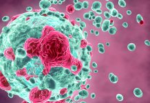 Heating tumours whilst they undergo chemotherapy can kill up to 98% of brain cancer cells chemotherapy