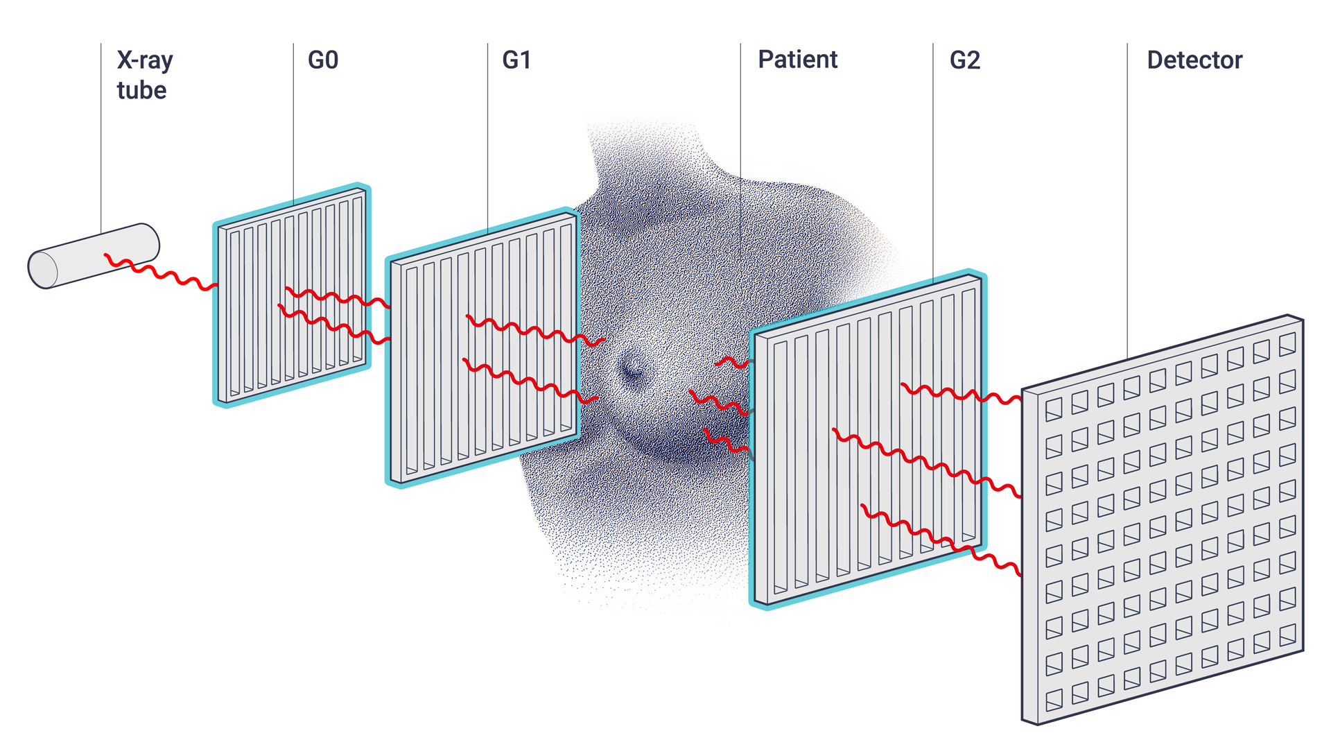 breast cancer diagnosis