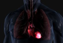 Younger people and the risk of sudden cardiac death cardiac death