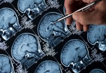 Illuminating the association between aluminium and familial Alzheimer’s disease familial Alzheimer’s disease