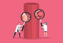 Prevalence of coronary artery disease among young people Prevalence of coronary artery disease among young people