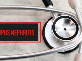 Lupus,Nephritis,Diagnosis,Word,With,Stethosco