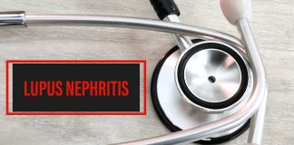 Lupus,Nephritis,Diagnosis,Word,With,Stethosco