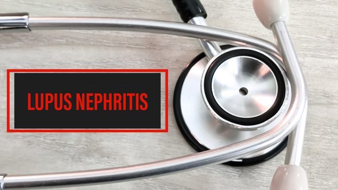 Lupus,Nephritis,Diagnosis,Word,With,Stethosco