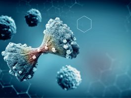 3d-printed tumour model