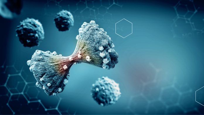 3d-printed tumour model