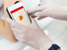 skin cancer screening