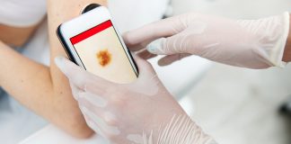 skin cancer screening