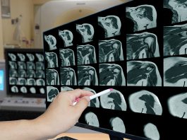 musculoskeletal radiology