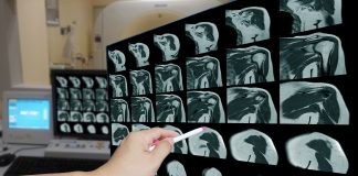 musculoskeletal radiology