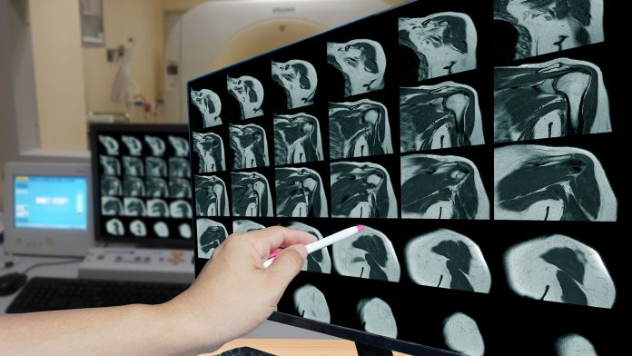 musculoskeletal radiology