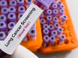 blood test, lung cancer