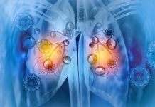 $7m ARPA-H funding will advance lung infection treatment lung infection