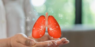 small-cell lung cancer