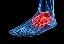 Phage therapy’s role in treating fracture-related infections fracture-related infections