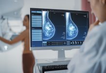 AI-powered breast cancer screening trial to revolutionise early detection in the UK breast cancer screening