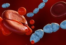 The true picture of sepsis in the UK sepsis