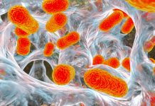 Antibiotic-resistant A. baumannii spreads in Malaysian hospital, raising global health concerns A. baumannii