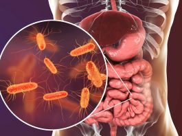 Gut bacteria may cleanse the body of toxic PFAS chemicals