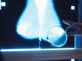 breast density monitoring